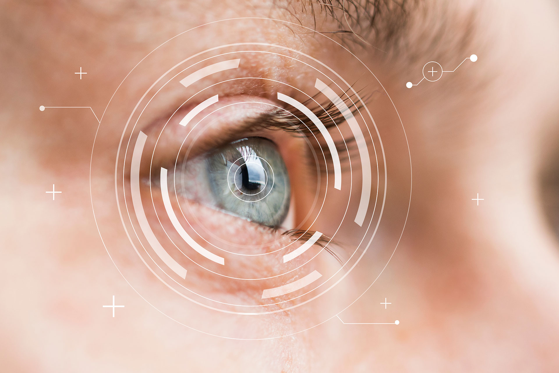 Close-up of human eye with digital scanning interface – concept of laser eye surgery and vision correction.